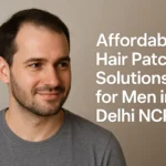 hair patch for men in delhi